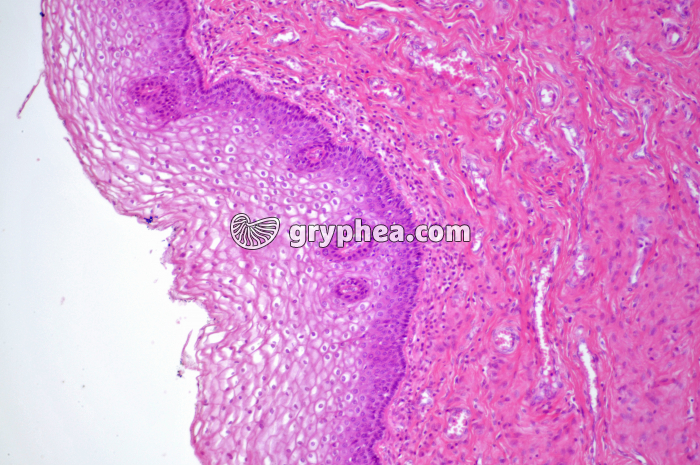 Muqueuse vaginale x40 - gryphea.com